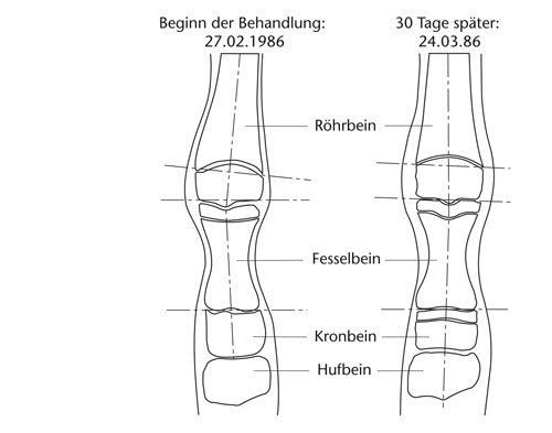 Achsfehlstellungen