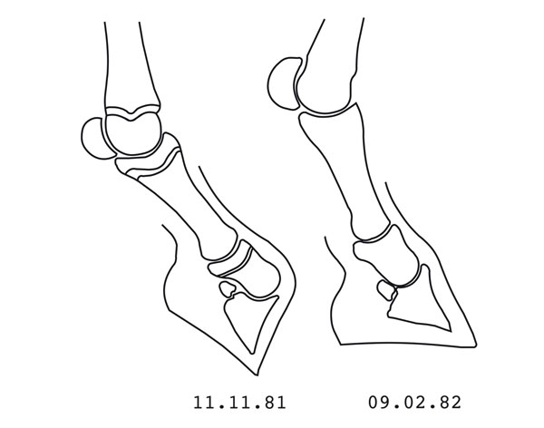 Schematische Darstellung der Streckung der Zehenachse nach Bockhufbehandlung (gezeichnet nach Röntgenaufnahmen)